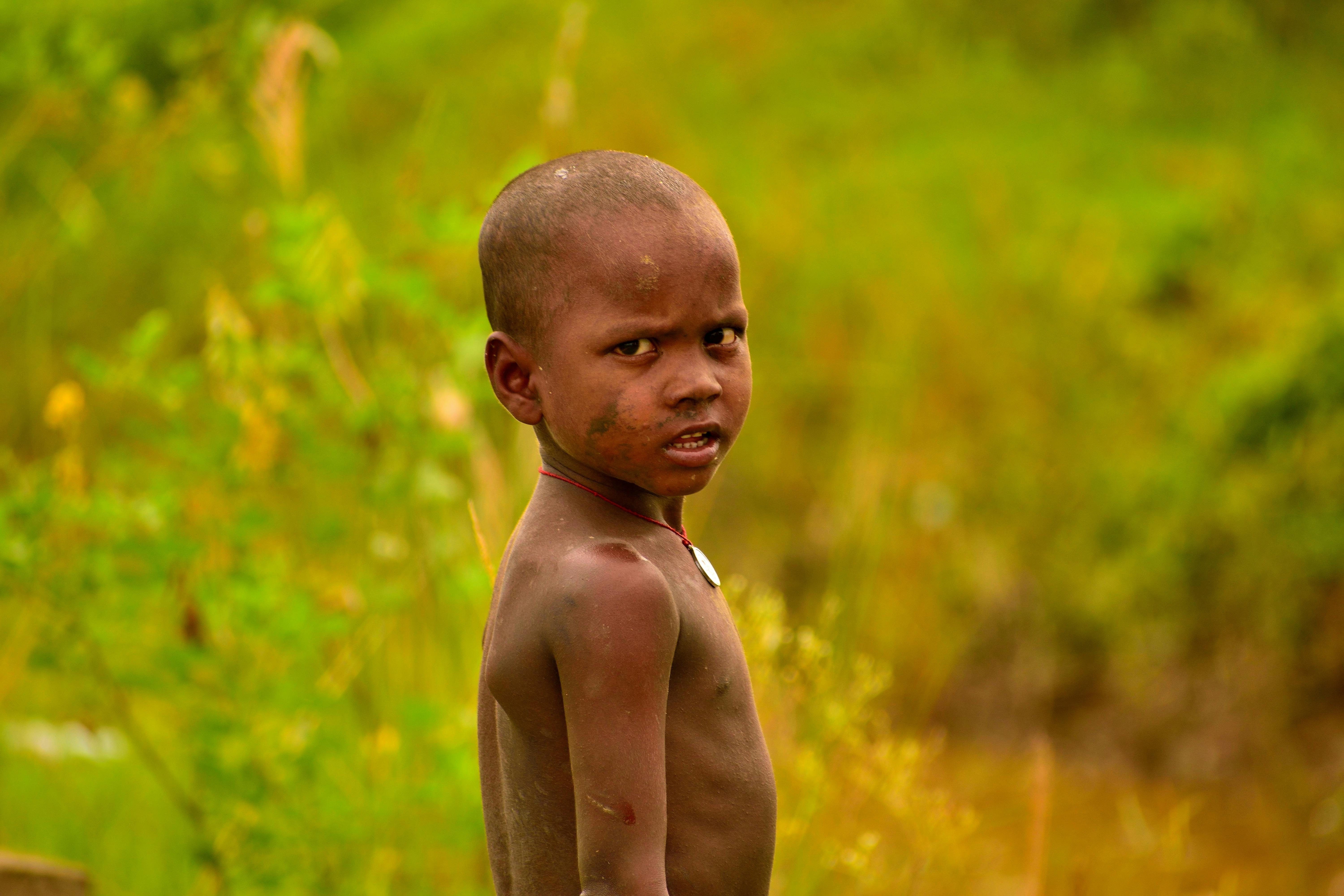 Signs of Malnutrition